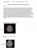 Quel est le rôle joué par le cerveau dans la commande volontaire ?